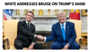 White House Explains Trump's Bruised Hand During Meeting With Macron